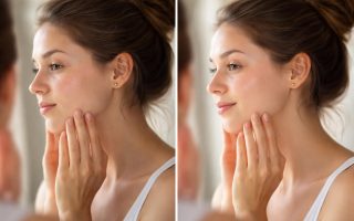 femme-peau-irritee-lumineuse-miroir